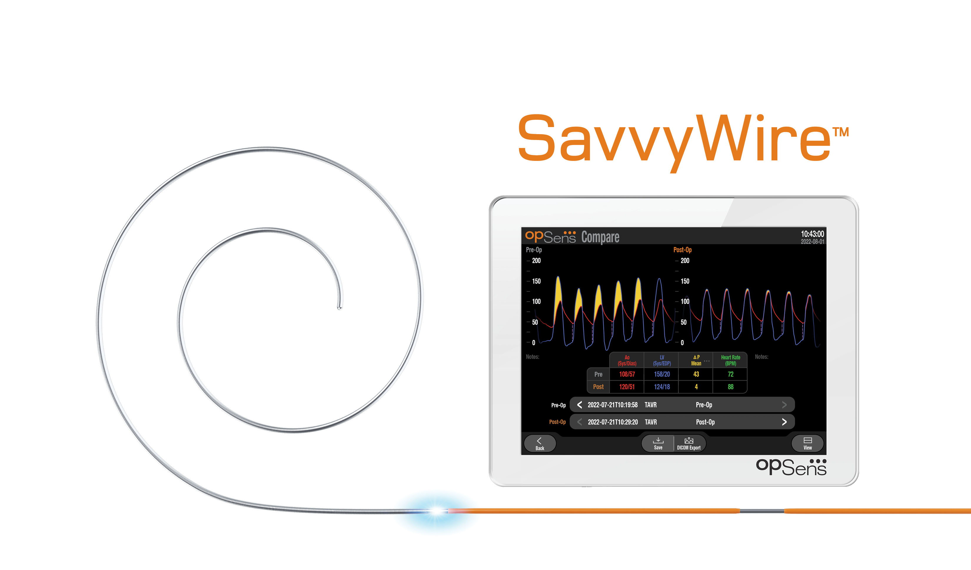 OpSens SavvyWire Guidewire For TAVR Procedures Receives FDA Clearance ...